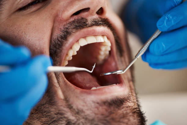 Best Emergency Dental Services for Seniors in Lynchburg, TN