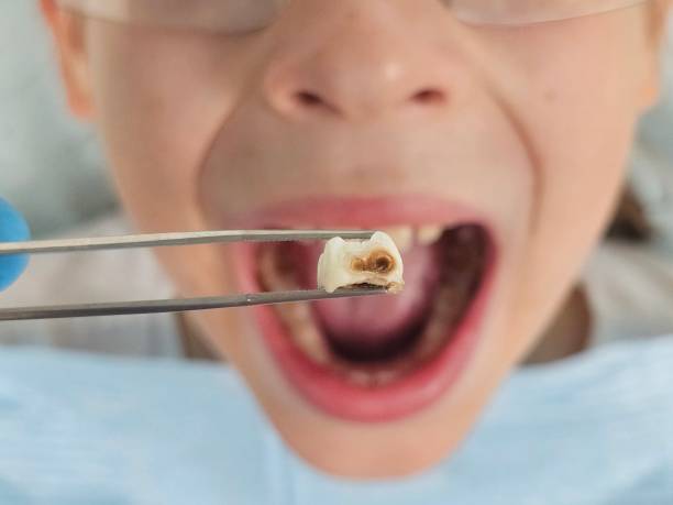 Best Weekend Emergency Dentist in Lynchburg, TN